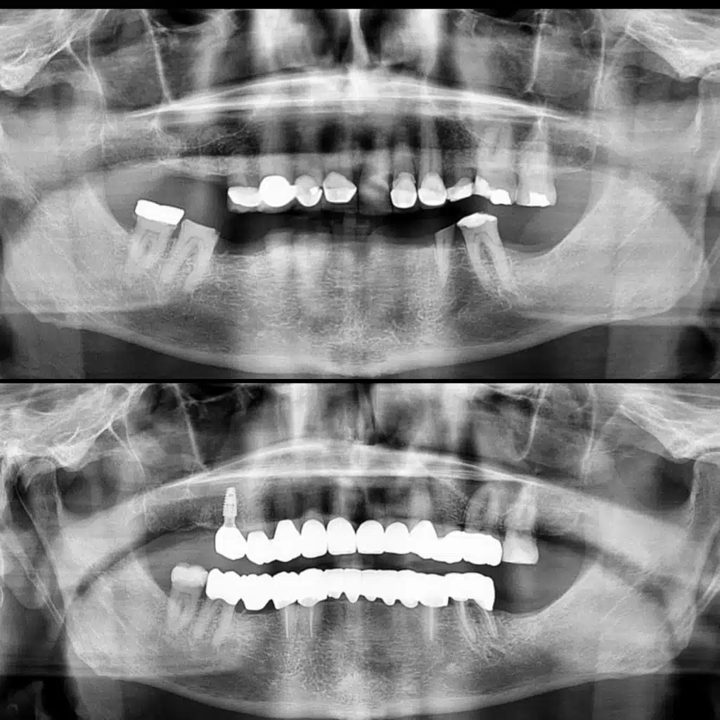 Diagnostico Radografico Guatemala Clinicas la Guardia