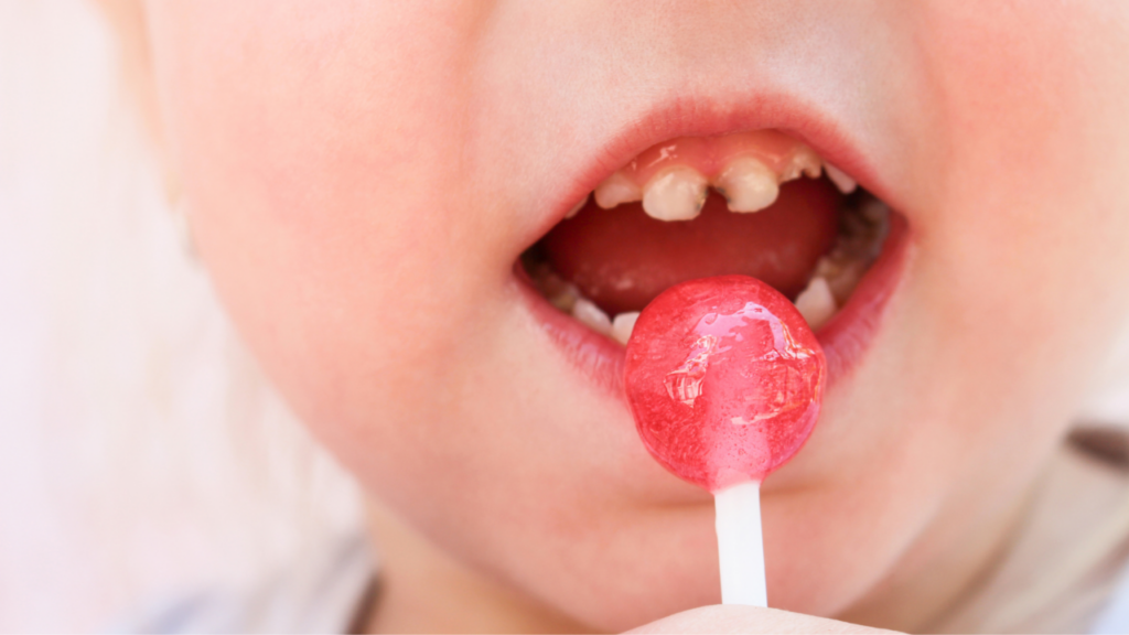 What is tooth decay and why does it occur in children?