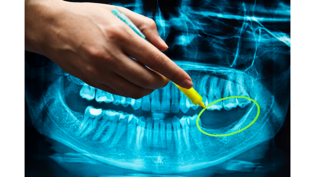 The Importance of Radiographic Diagnosis in Detecting Systemic Diseases