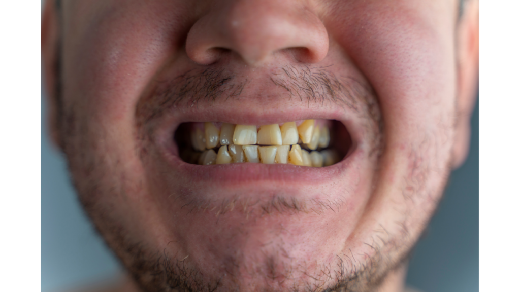 How Does Tobacco Affect Your Oral Health?