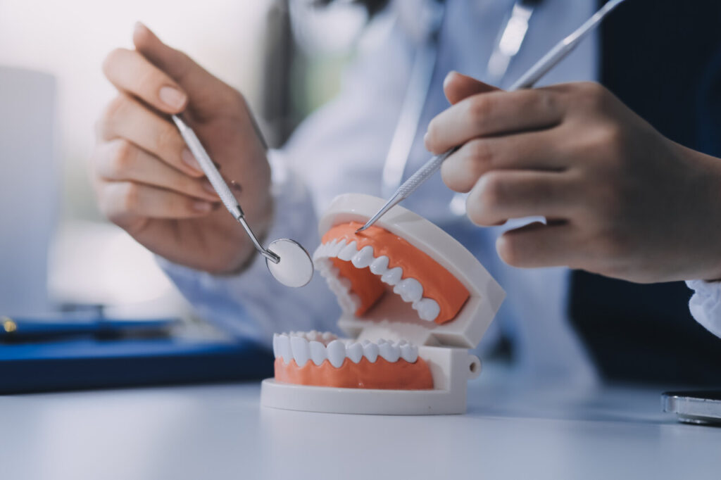 ¿Qué es una limpieza dental profesional?